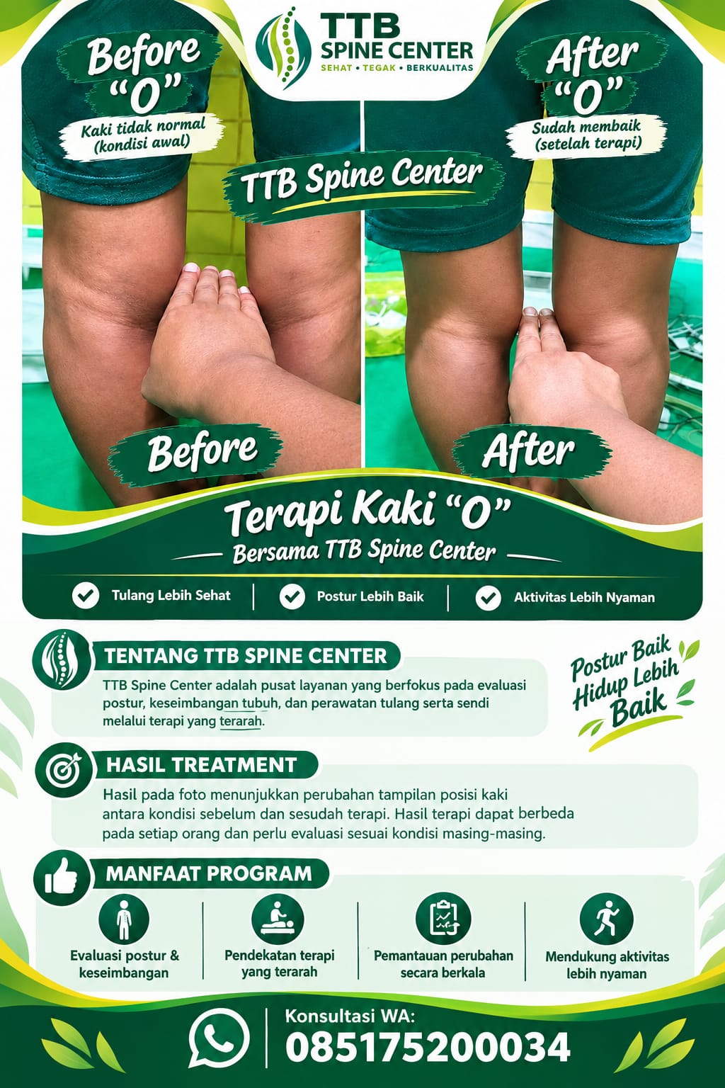 Aktivitas terapi TTB Spine Center