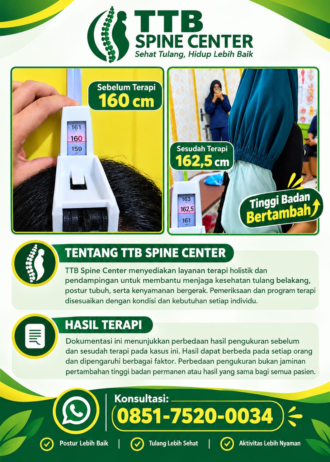 Ruang layanan TTB Spine Center