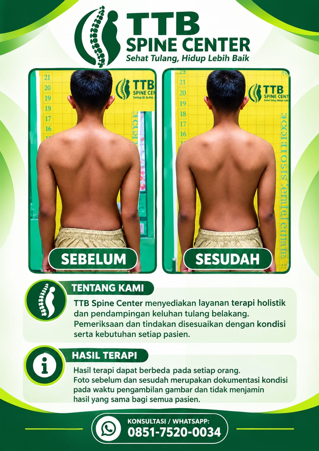 Fasilitas TTB Spine Center