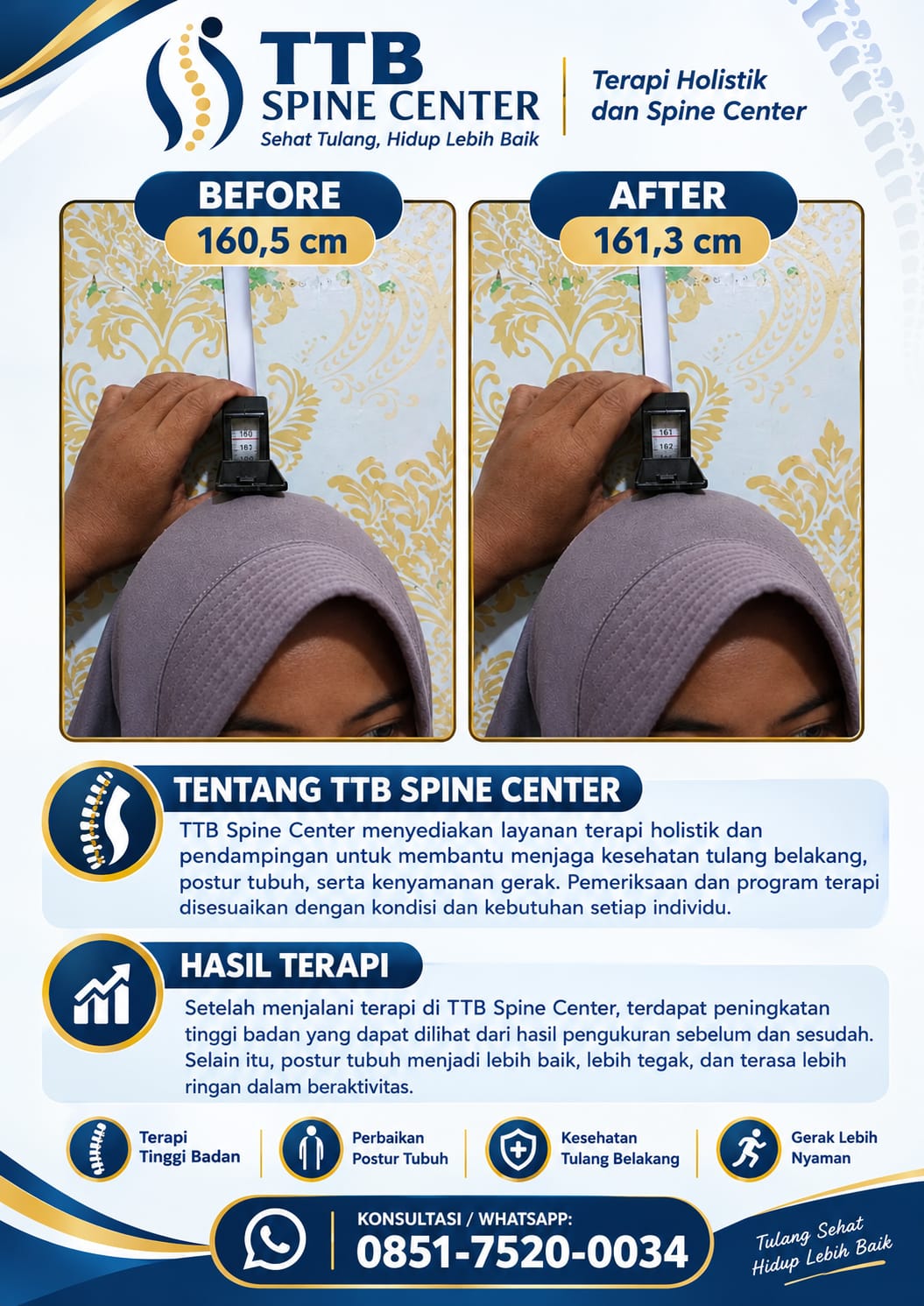 Pelayanan TTB Spine Center