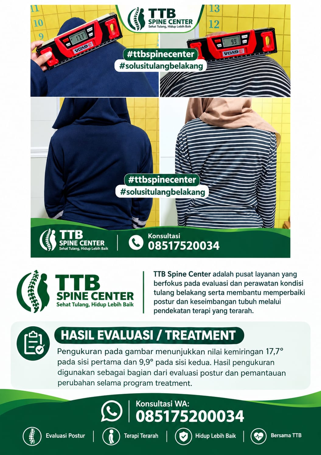 Konsultasi TTB Spine Center